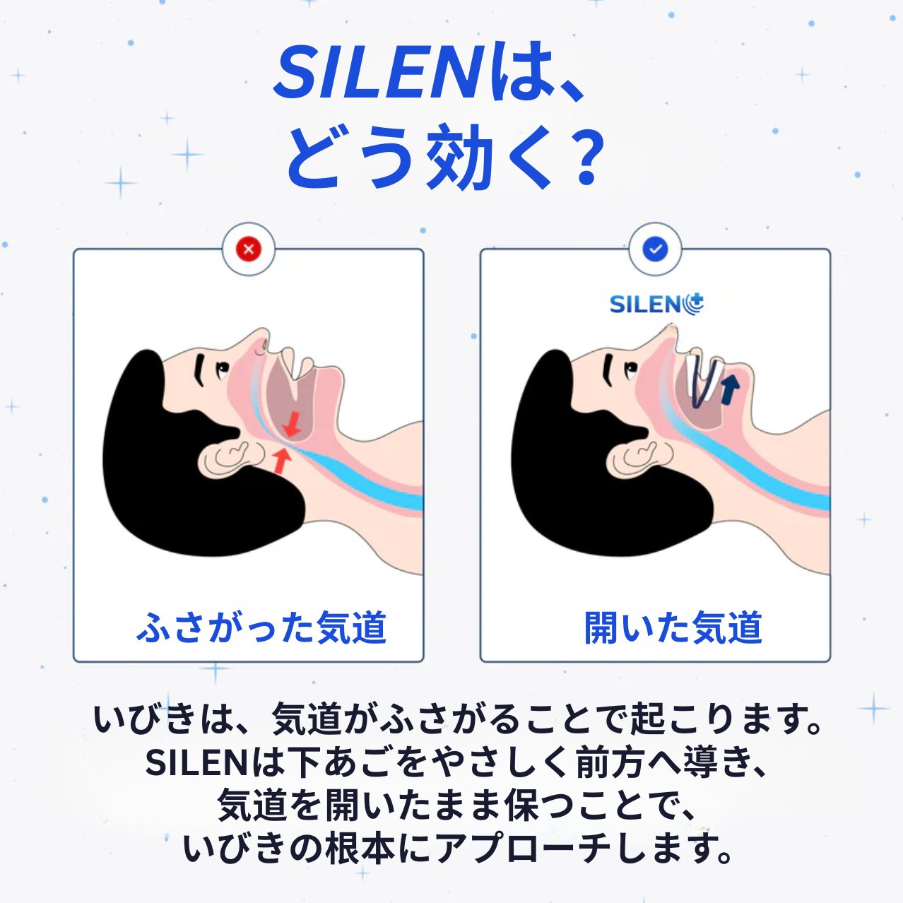 SILEN™ いびき防止マウスピース