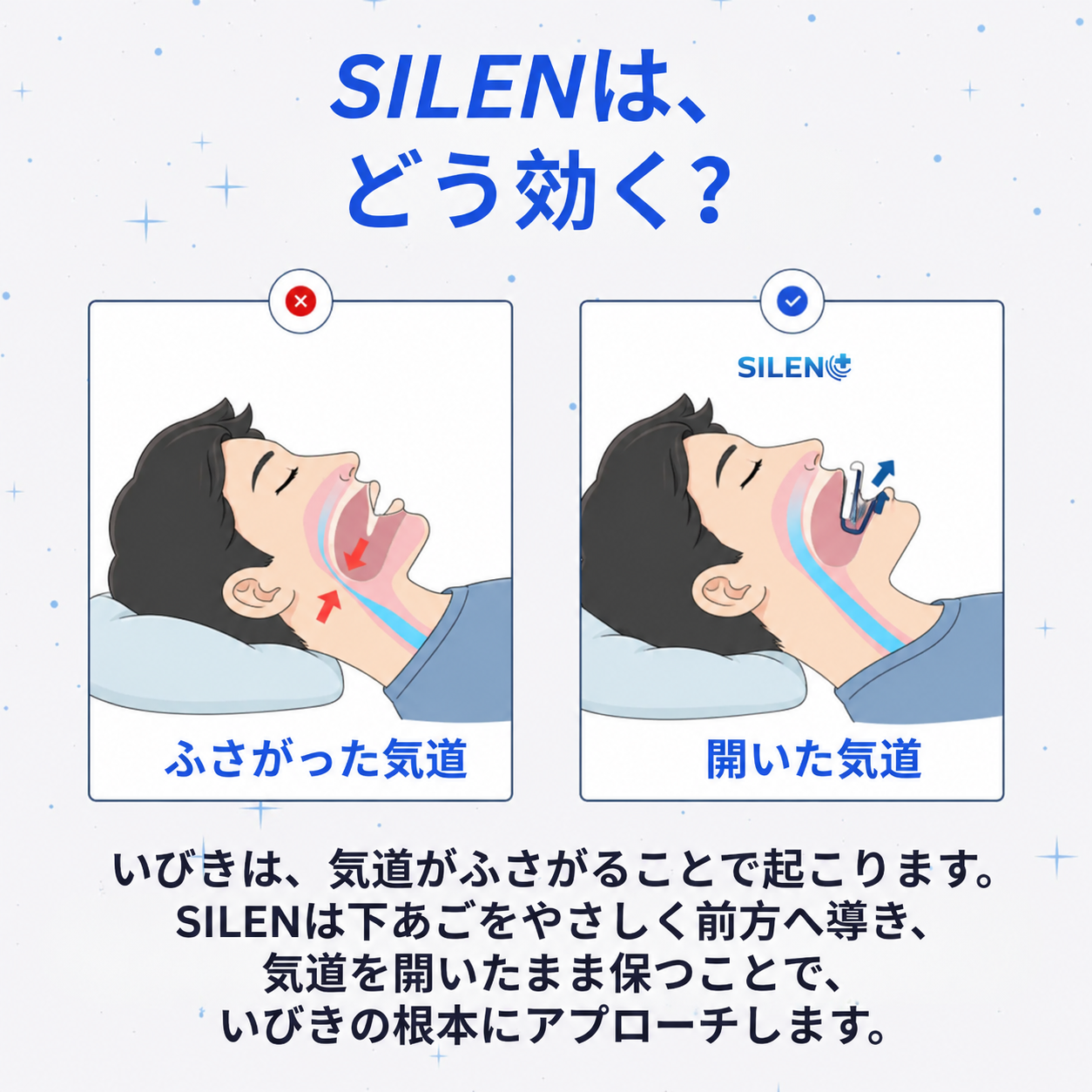 SILEN™ いびき防止マウスピース